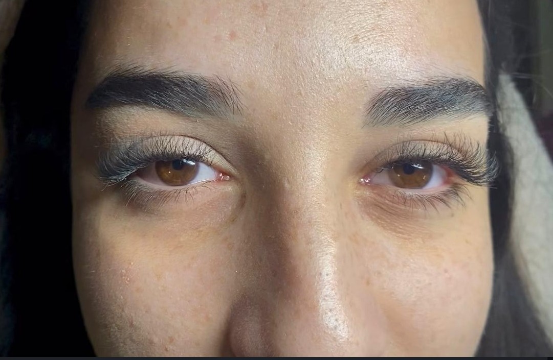 Hibrid tehnika trepavica Niš — kombinacija prirodnog i volumena