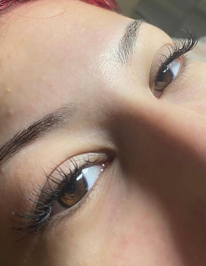 Posle tehnika 1:1 trepavice Niš