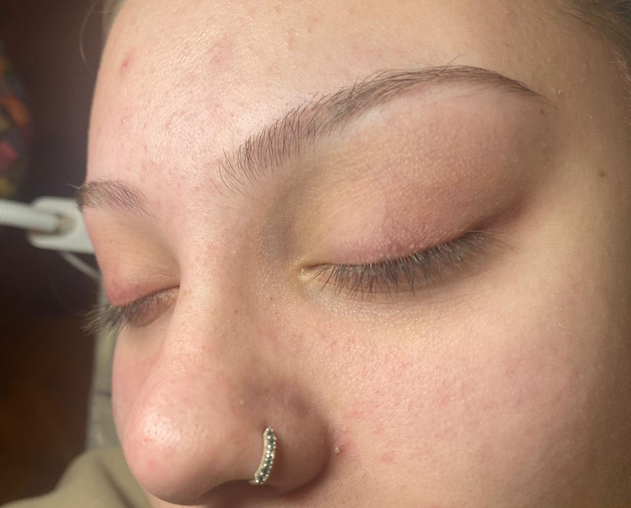 Pre mega volumen trepavice