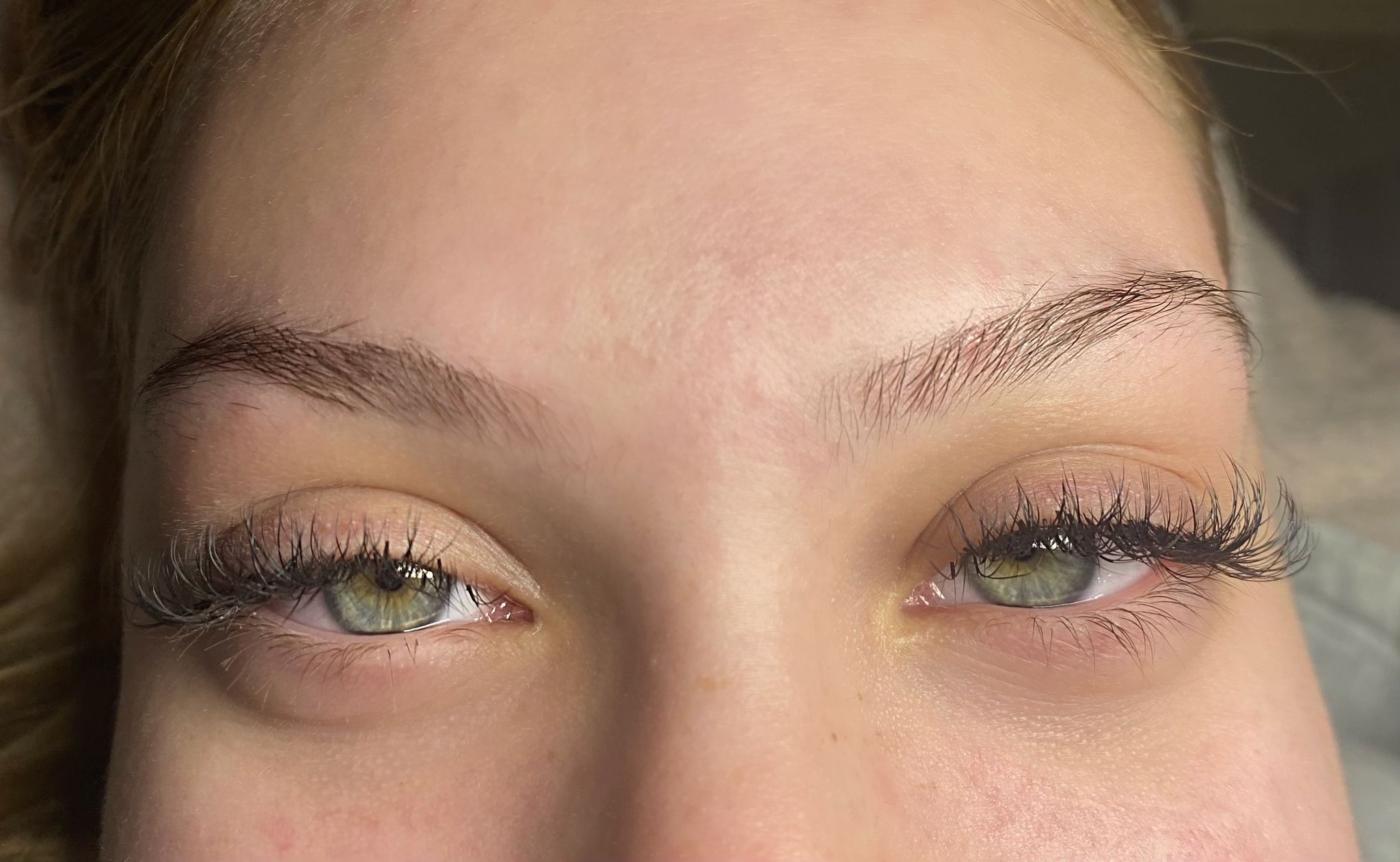 Ypsilon tehnika volumen trepavice Niš — gušći izgled