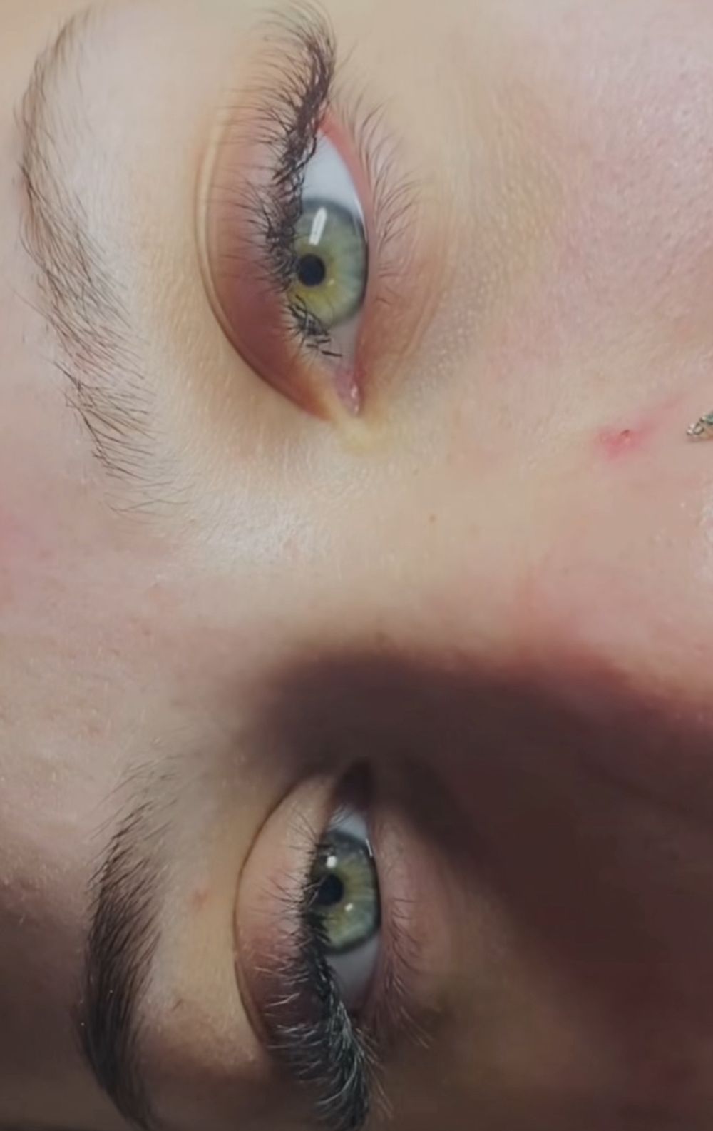 Posle hibrid tehnika trepavice Niš